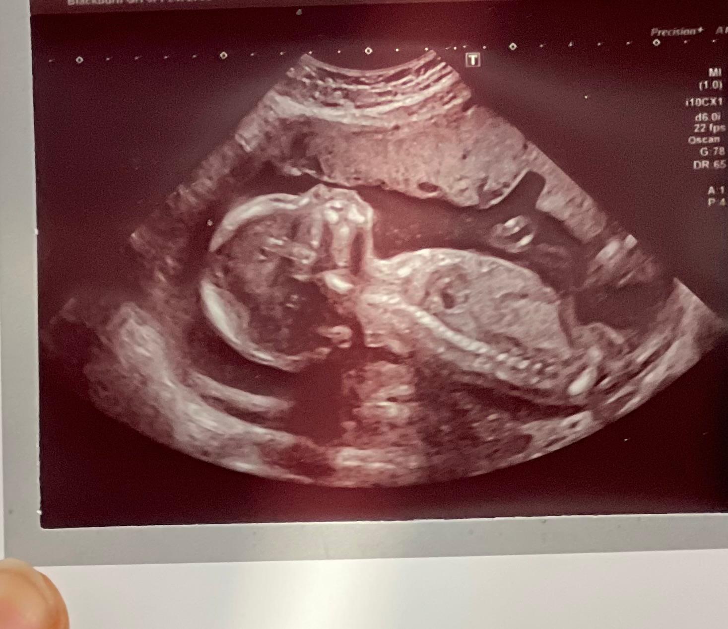 Holding ultrasound scans as our baby grew